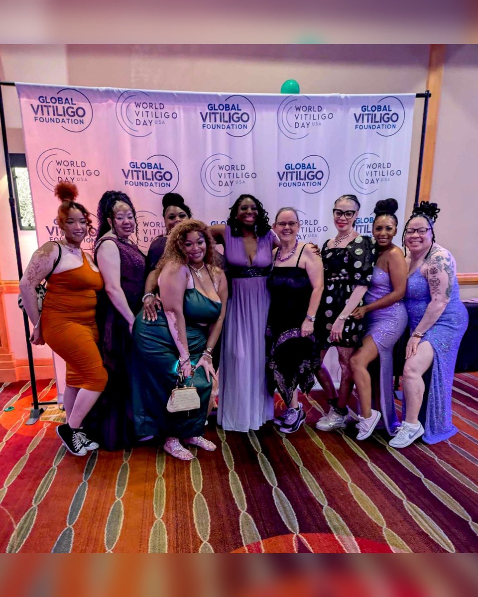 LittyLigo's tweet image. Missing our sneaker ball vitiligo baddies 🫶🏾

liinks.co/littyligo