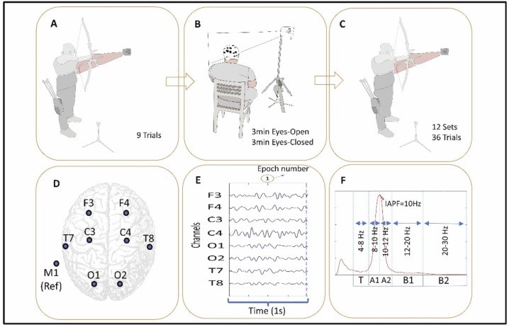 Research using Mentalab's lightweight and wireless EEG system sheds light on the neural underpinnings of elite athletic performance in archers: tinyurl.com/yyj3993h

#PoweredByMentalab 

Want to explore how Mentalab can support your research?  Contact us or book a demo!