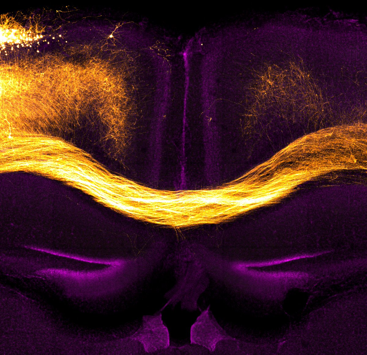 Sriram S (@sriram_s433) on Twitter photo For this #FluorescenceFriday , 'Devil's Horns': Axons from mutant mouse callosal projection neurons that misproject into cingulate cortex For this #FluorescenceFriday , 'Devil's Horns': Axons from mutant mouse callosal projection neurons that misproject into cingulate cortex