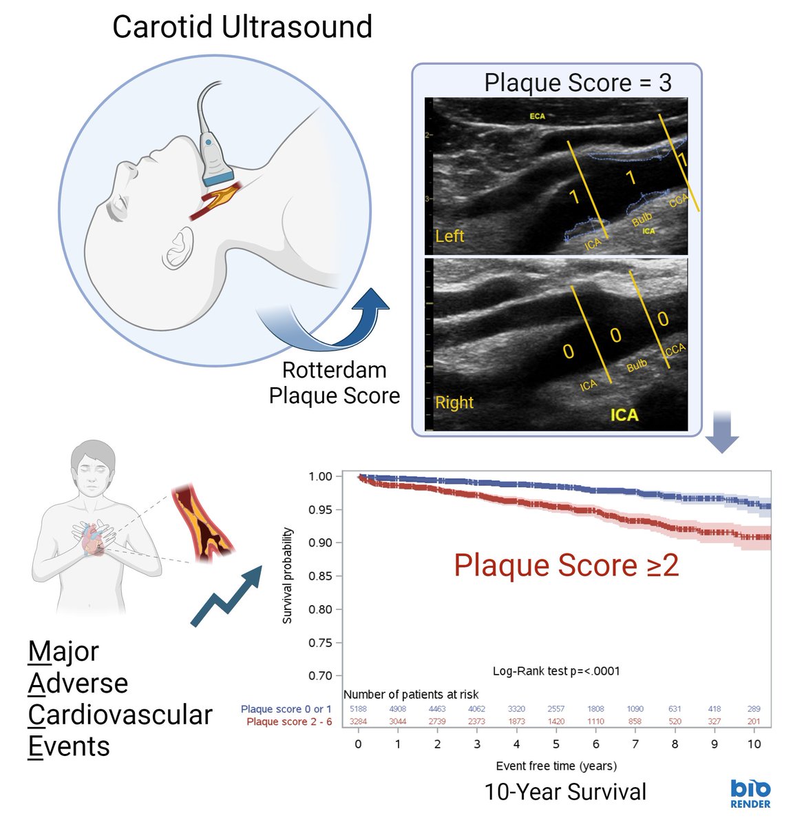 Cardiovascular Imaging Network at Queen's (CINQ) (@cinq_lab) on Twitter photo New publication by CINQ, congrats team!
Carotid plaque score is associated with 10-year major adverse cardiovascular events in low–intermediate risk patients referred to a general cardiology community clinic. academic.oup.com/ehjcimaging/ar… 
<a href="/amerjohri/">Amer Johri</a> <a href="/DrMFHetu/">Marie-France Hétu, PhD</a> <a href="/nickgrubic/">Nicholas Grubic</a> New publication by CINQ, congrats team!
Carotid plaque score is associated with 10-year major adverse cardiovascular events in low–intermediate risk patients referred to a general cardiology community clinic. academic.oup.com/ehjcimaging/ar… 
<a href="/amerjohri/">Amer Johri</a> <a href="/DrMFHetu/">Marie-France Hétu, PhD</a> <a href="/nickgrubic/">Nicholas Grubic</a>