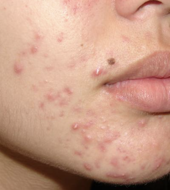 PŪNGAO ⚡️🍯 tweet media