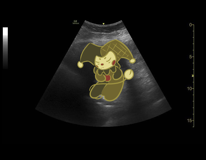 alma_chroma's tweet photo. @korbydaze Baby https://t.co/ubEaDYlCV0