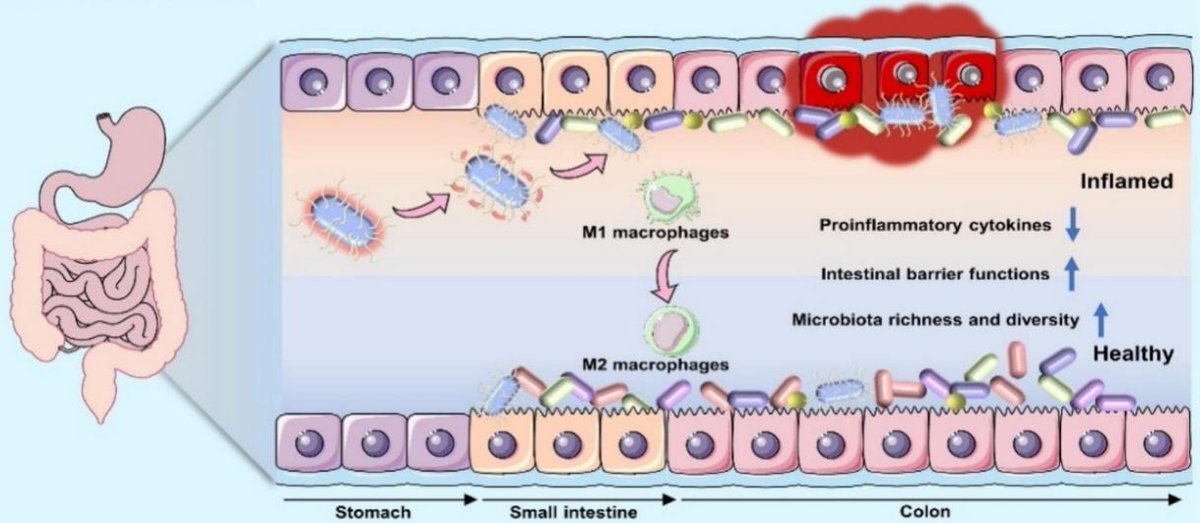 JCRnEDITORS's tweet image. Bioorthogonal conjugation and responsive nanocoating of probiotics for inflammatory bowel disease.
| Peng Li @HenanUniversity |
#probioics #conjugate #EntericCoating #InflammatoryBowelDisease
doi.org/10.1016/j.jcon…