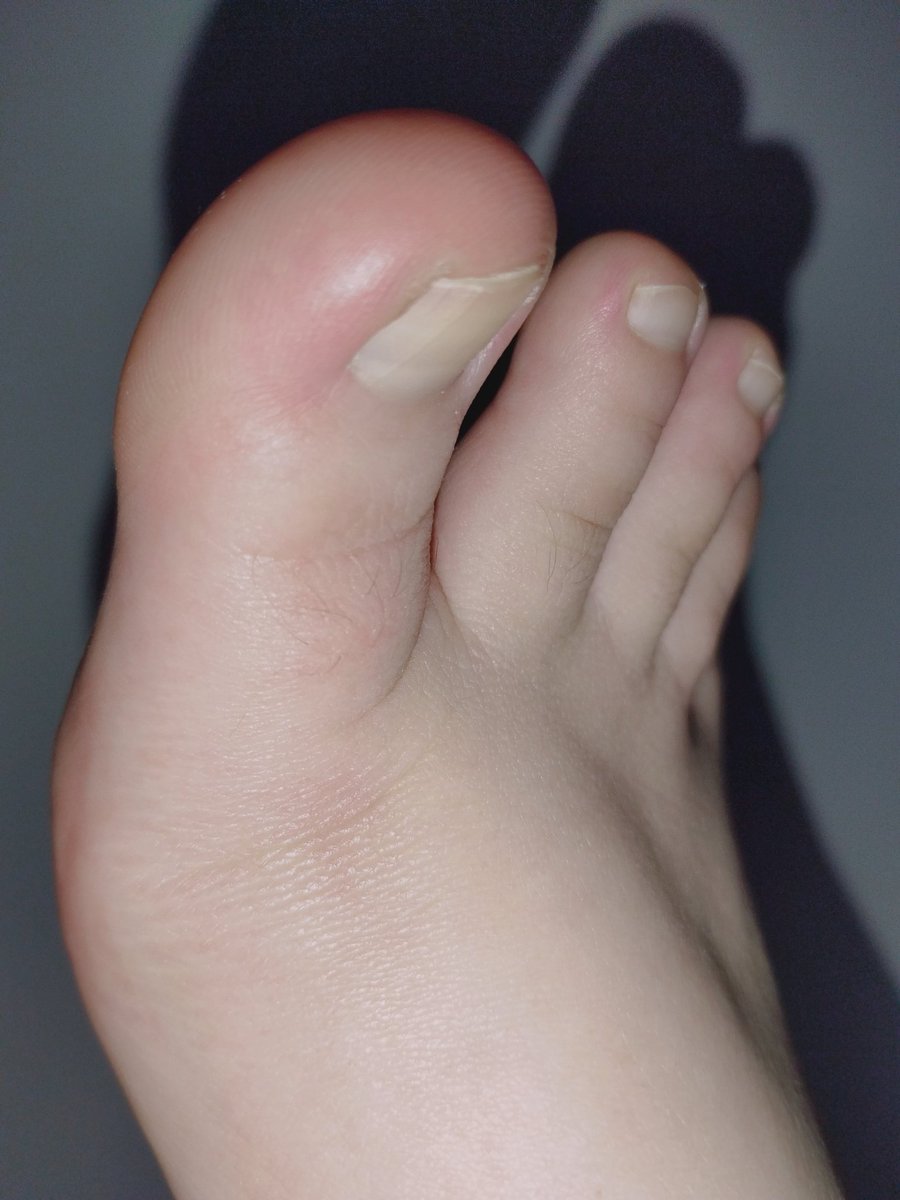 feetcolli's tweet photo. #feetnails #FeetAndMeatKing #feetworship #Feet #foot #feetfetish #fingers #nsfw #Crypto https://t.co/zxn40ZP6vq