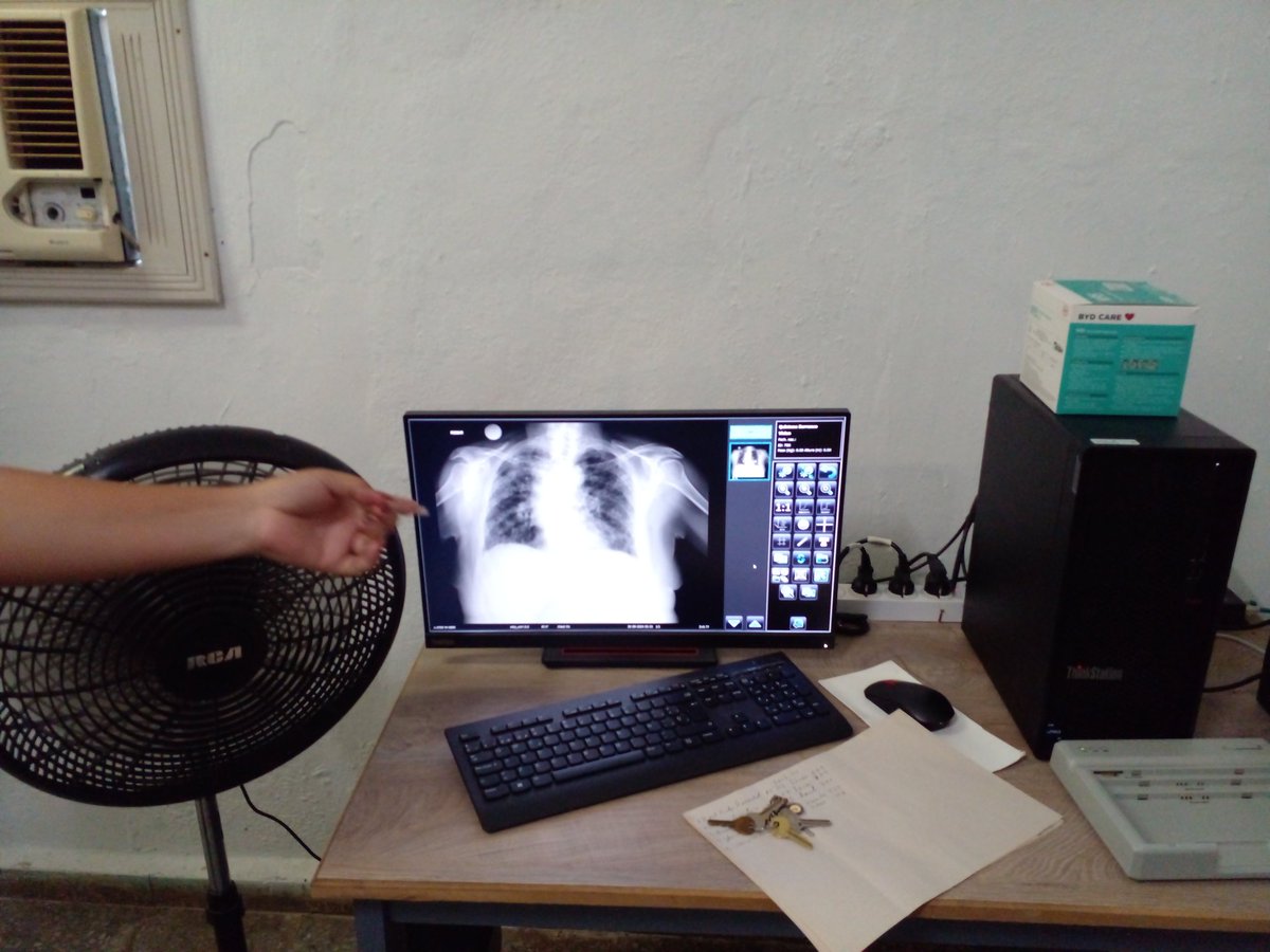 ⚕️ Los presentes conocieron mediante la intervención de Daylen Infantes, directora municipal de salud sobre las labores constructivas en el vacunatorio y el servicio disponible las 24 horas del RX Digital.
#MatancerosEnVictoria