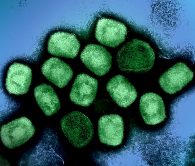 richardhirschs1's tweet photo. #BREAKING
The #FDA approves #ACAM2000 vaccine for #Mpox prevention, but who would possibly take it?
8 critical points:
✴️ACAM2000 is second-generation vaccine that contains a live vaccinia virus that replicates efficiently in humans (#JYNNEOS and LC16 are third-generation vaccines that do not replicate).
✴️The US has 200 million doses stockpiled.
✴️It needs to be administered by using a bifurcated steel needle, dipped into the vaccine, and then introduced into the upper arm multiple times.
✴️The vaccine causes a Vaccinia Pox infection , hence it is not given to the immunocompromised.
✴️The vaccine may cause myocarditis and pericarditis.
✴️ Serious health problems, including life-threatening, can also occur in unvaccinated people who are accidentally infected by someone who has recently received the vaccine.
✴️I’m unsure who the #FDA intends to give this vaccine to. The developed world won’t accept it, and Africa can’t use it safely (unless the situation is dire)🤷♂️🤷♂️
✴️The labelling will be for those at high risk of Mpox infection, where there is no alternative.
What does the FDA/CDC see coming our way?
Do they see a #Pandemic that will use more than the millions of doses of Jynneos/LC16 currently available?
@RickABright @DrEricDing
https://t.co/H6wT221HLd