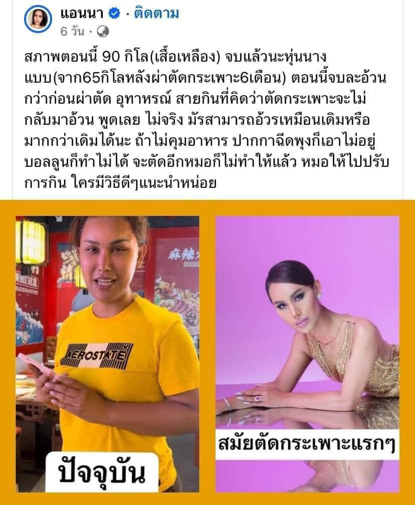 bluesherbet_'s tweet photo. แอนนา ทีวีพูล ชีไปตัดกระเพาะ แล้วน้ำหนักยังเด้งขึ้นมา ใครที่คิดว่าตัดกระเพาะจะครบจบในครั้งเดียว ต้องลองคิดดูดีๆนะ

(ในติ๊กต่อ��เห็นอีกเคสนึง ผญ หนัก 100ปลายๆ เกิน 150 อ่ะ อันนี้ผ่าตัดตามคำแนะนำแพทย์ เพราะเข้าข่ายจริงๆ ชีตัดมาก็ไม่หิวอยู่พักนึง ลดไปประมาณ10โล จากนั้นบุฟเฟต์ฉ่ำ) https://t.co/7RoaXR4Ux6