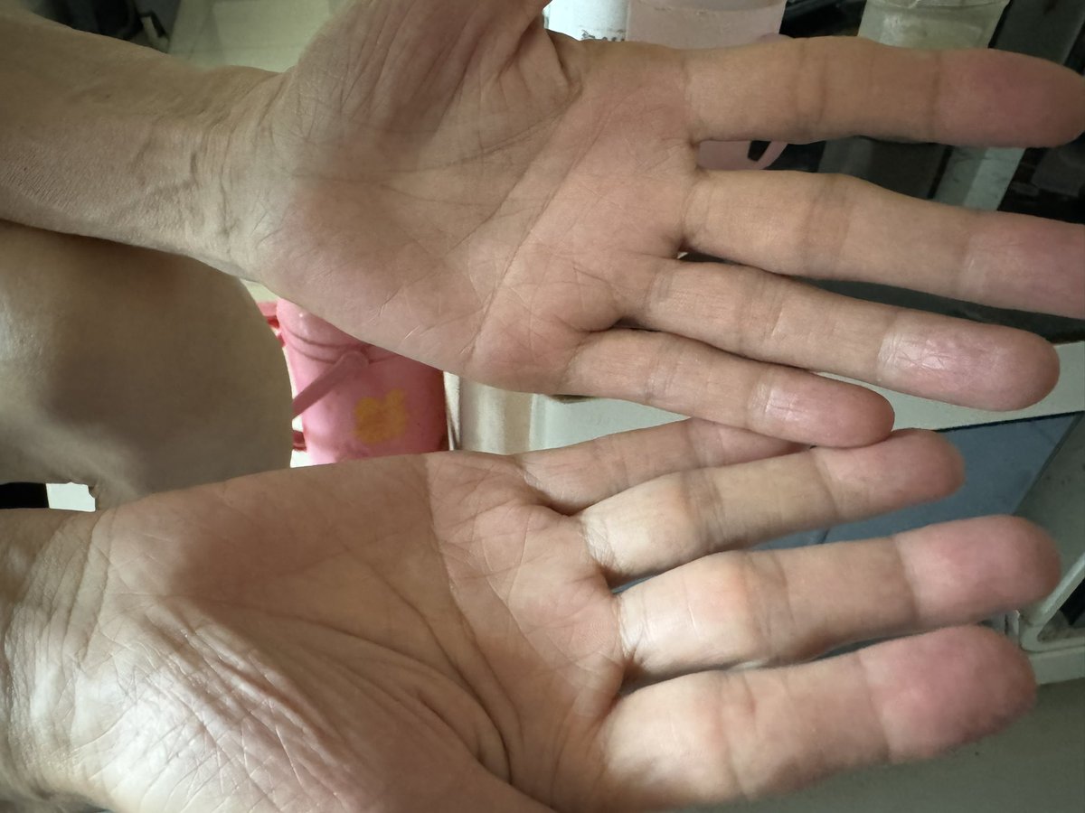 我老头的手也还可以吧😁