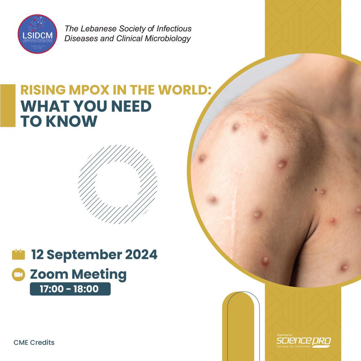 SciencePRO2012's tweet image. Join us for an important webinar on September 12, 2024 entitled: “Rising Mpox in the World: What You Need to Know”, organized by the LSIDCM.
 
🗓 Date: September 12, 2024
🕒 Time: 17:00 – 18:00
💻 Virtually over Zoom (Registration Link: sciencepro.me/24th-annual-co…)
 
#MpoxAwareness