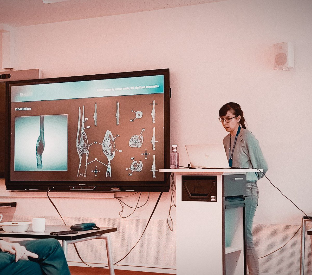 monqso's tweet photo. Yesterday, I talked about #paleopathologies 🦴 and #islanders 🏝️ at #EAVP2024. If you missed it, you can check the abstract here ➡️
https://t.co/sOukWRcvPr. What a great experience to present in the Arctic! 🐻‍❄️ #ThisIsGRICA #PaleoGalicia #Paleoislands #womeninSTEM https://t.co/N2JpUcmN7W