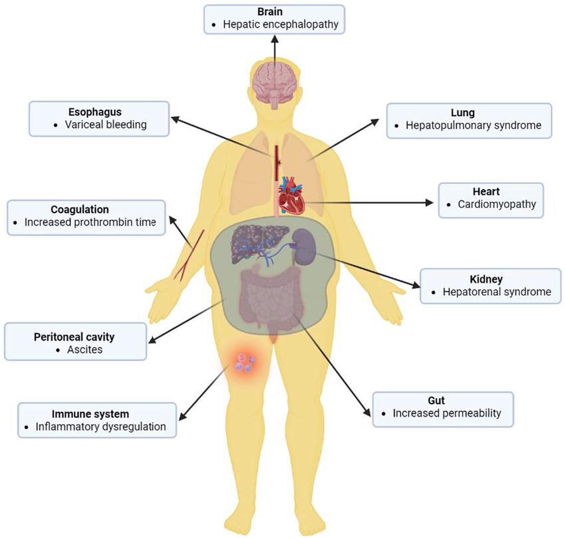 Today's Paper of the Day is on prognosis in cirrhosis: A shifting paradigm
criticalcarereviews.com/latest-evidenc…

Join us to read 1 paper per day and stay up-to-date as we cover the spectrum of critical care across 2024