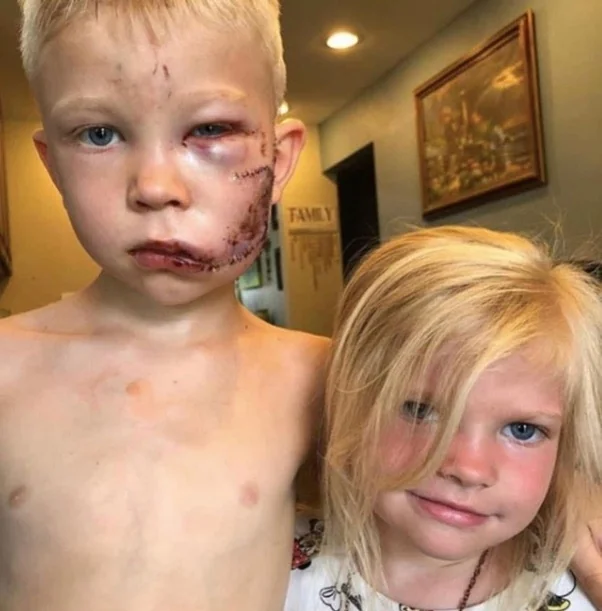A true hero: 6 years old Bridger from Cheyenne, Wyoming, saved his sister from an attacking wild dog. After getting bit several times he grabbed her hand and ran for safety. He later said “If someone had to die, I thought it should be me.”