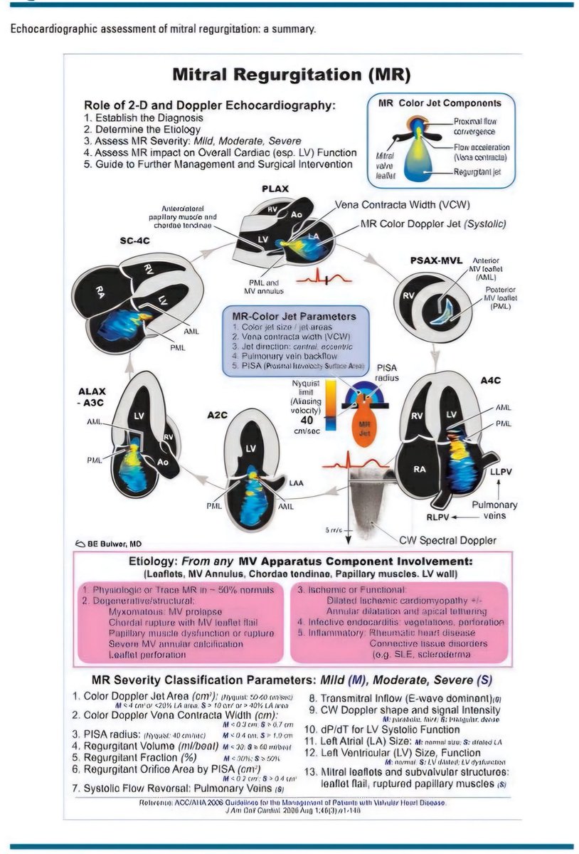🔴Echocardiographic Assessment of the Mitral Regurgitation (MR) ⤵️🔹

 #Cardiology #FOAMed #MedEd #medstudent #paramedic #Cardiology #CardioEd #medtwitter #meded #CardioTwitter #cardiotwiteros  #MedX #cardiovascular #MedTwitter #medical #medEd #cardiotwitter #medicineball