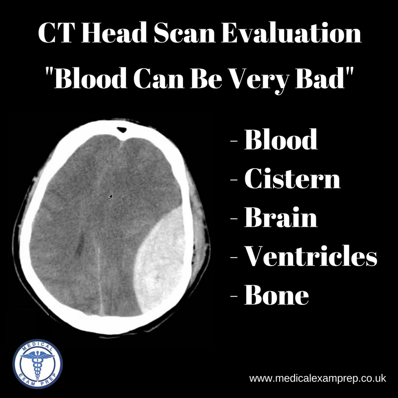 MedicalExamPrep's tweet photo. The mnemonic 'Blood Can Be Very Bad' is a useful way to remember a systematic approach to interpreting emergency CT head scans. #FOAMed #meded #medschool #medstudent #plab #plab1 #mrcem #mrcemintermediate #frcr1 #frcr #frcr2a https://t.co/6EUfIQI2SM