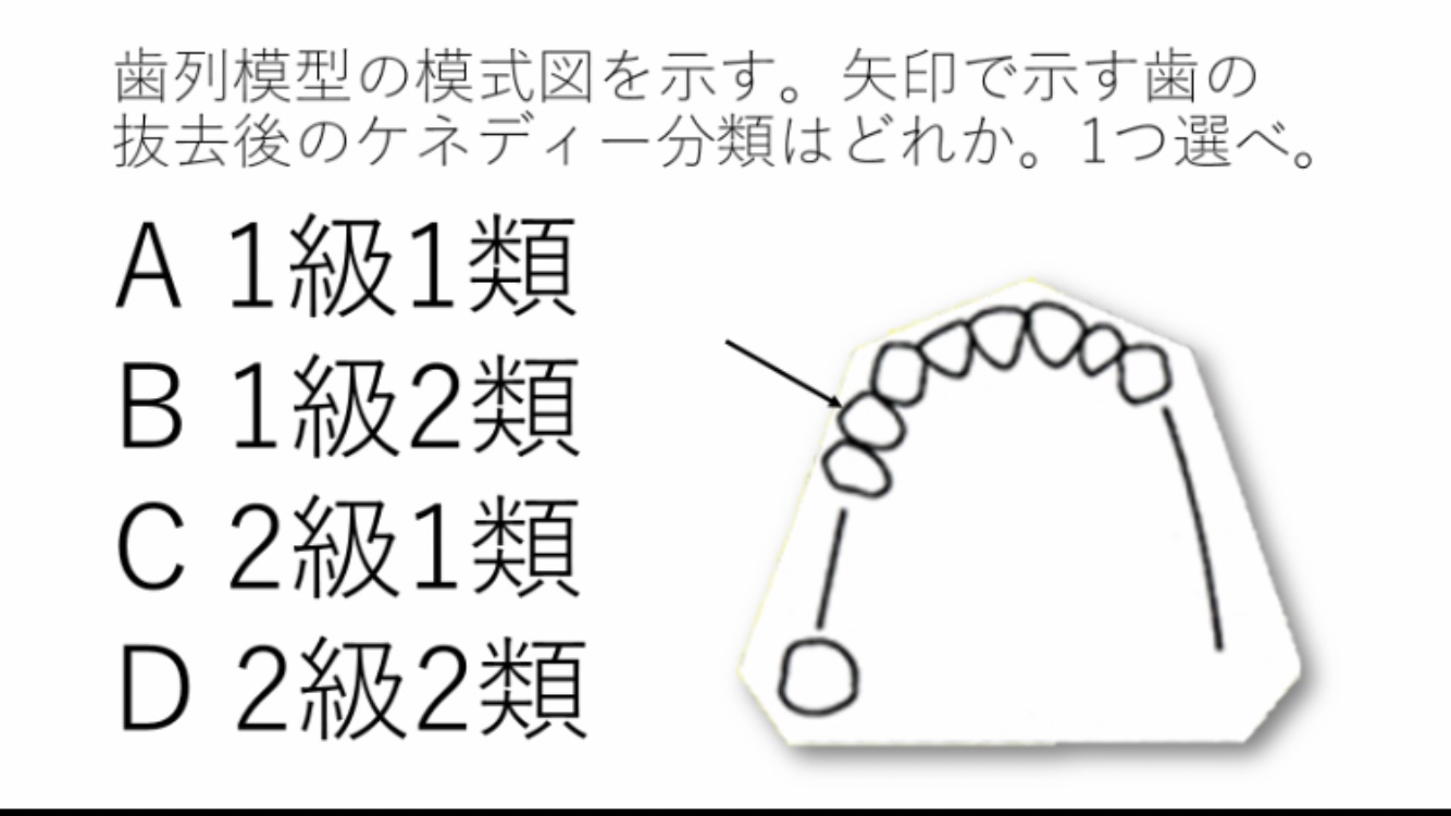 ロムニーハウス サマーハウス講座　プレミアム講座　年末講義　ファイナル講義 119回歯科医師国家試験対策 ロムニーハウス勉強会【講師 Dr.N