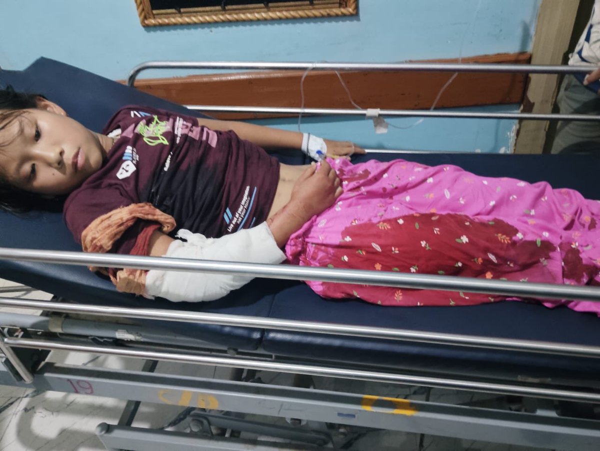 madhukishwar's tweet photo. Meitei Victims of latest attacks by Kuki terrorists in Manipur. https://t.co/MSfjVT3jpx