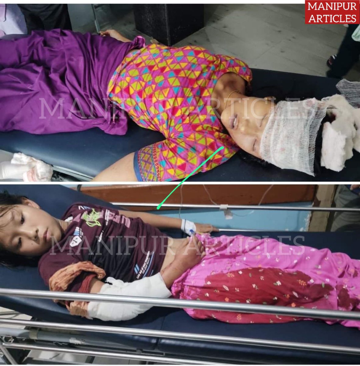chingthou's tweet photo. A #Meetei woman and her daughter grievously injured in an unprovoked attack by #KukiTerrorists in Koutruk, Imphal West, #Manipur, today https://t.co/U8NJRog9XH