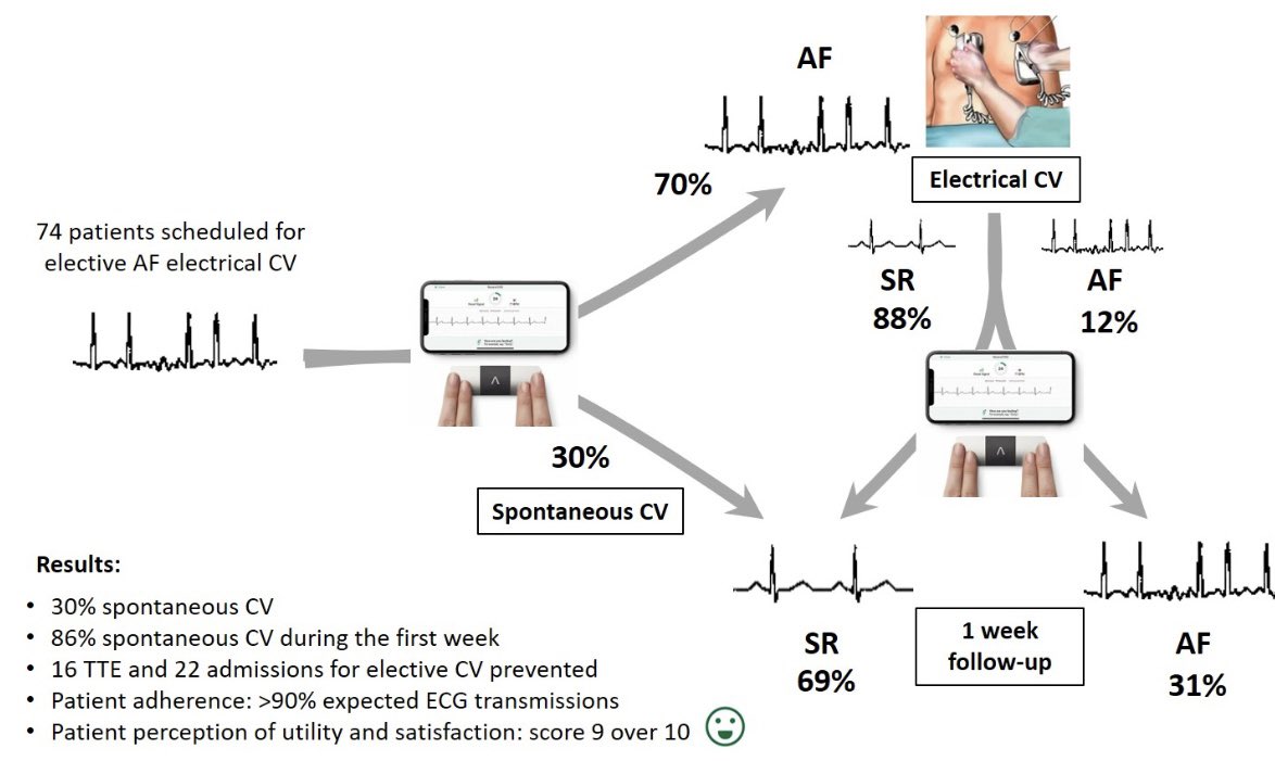 Juan Benezet (@juanbenezet) on Twitter photo Presentamos en #ESC2024 los resultados de KARDIOVER, monitorización 🫀📲en pacientes con FA programados a ⚡️CVE ambulatoria⚡️
Gracias a todos los amig@s que lo habéis hecho posible! <a href="/ritmo_SEC/">Asociación del Ritmo Cardiaco</a> <a href="/secardiologia/">Soc Esp Cardiología</a> <a href="/SIAC_cardio/">SIAC</a> <a href="/UICARdiologia/">Unidad Integral de Cardiología - UICAR</a> <a href="/quironsalud/">quirónsalud</a> <a href="/Hospital_LaLuz/">Hospital La Luz</a> Presentamos en #ESC2024 los resultados de KARDIOVER, monitorización 🫀📲en pacientes con FA programados a ⚡️CVE ambulatoria⚡️
Gracias a todos los amig@s que lo habéis hecho posible! <a href="/ritmo_SEC/">Asociación del Ritmo Cardiaco</a> <a href="/secardiologia/">Soc Esp Cardiología</a> <a href="/SIAC_cardio/">SIAC</a> <a href="/UICARdiologia/">Unidad Integral de Cardiología - UICAR</a> <a href="/quironsalud/">quirónsalud</a> <a href="/Hospital_LaLuz/">Hospital La Luz</a>