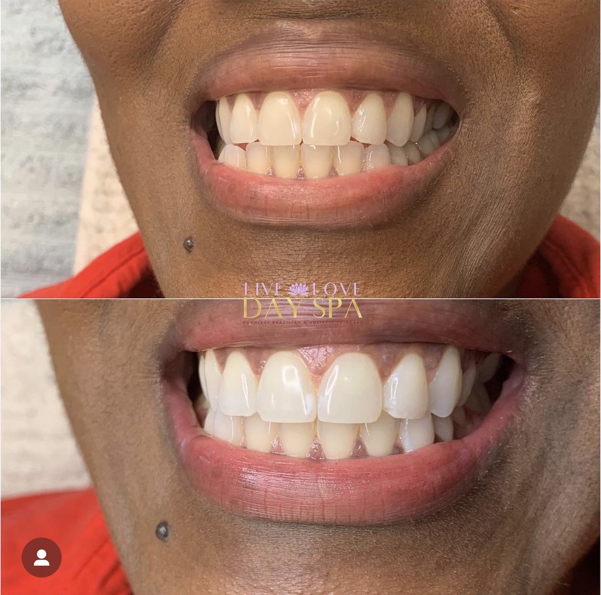 LiveLoveDaySpa's tweet photo. Labor Day Sale! 50% off Teeth Whitening services. Using code LIVE24
#teethwhitening #houston #labordayclassic 

https://t.co/QgFEzH4ZOY https://t.co/4GM5PMyh0Q
