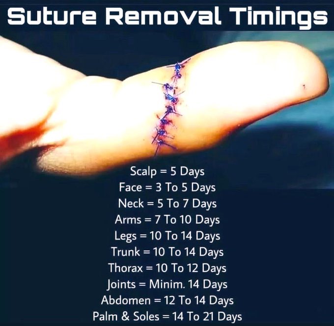 Suture Removal Timings ￼📌