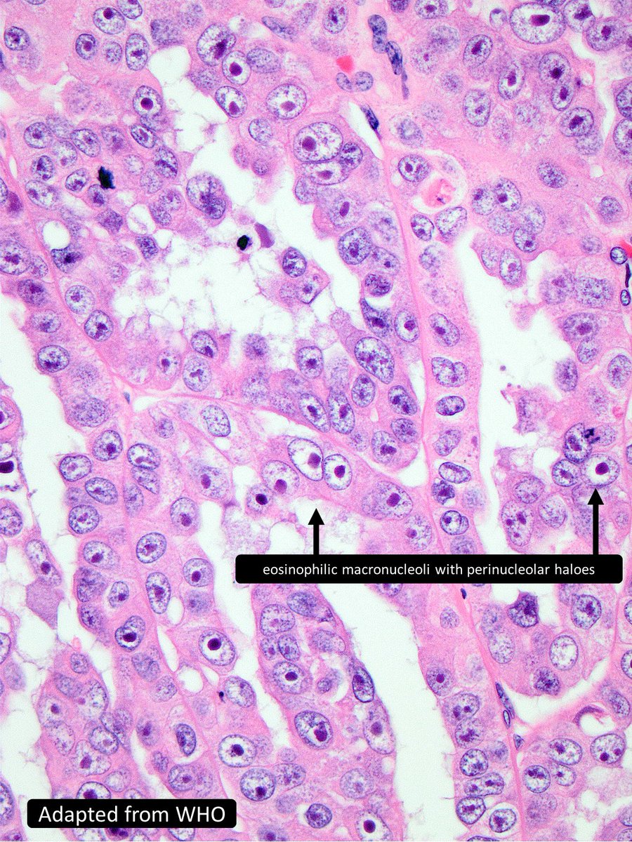 Charlie Herndon tweet media