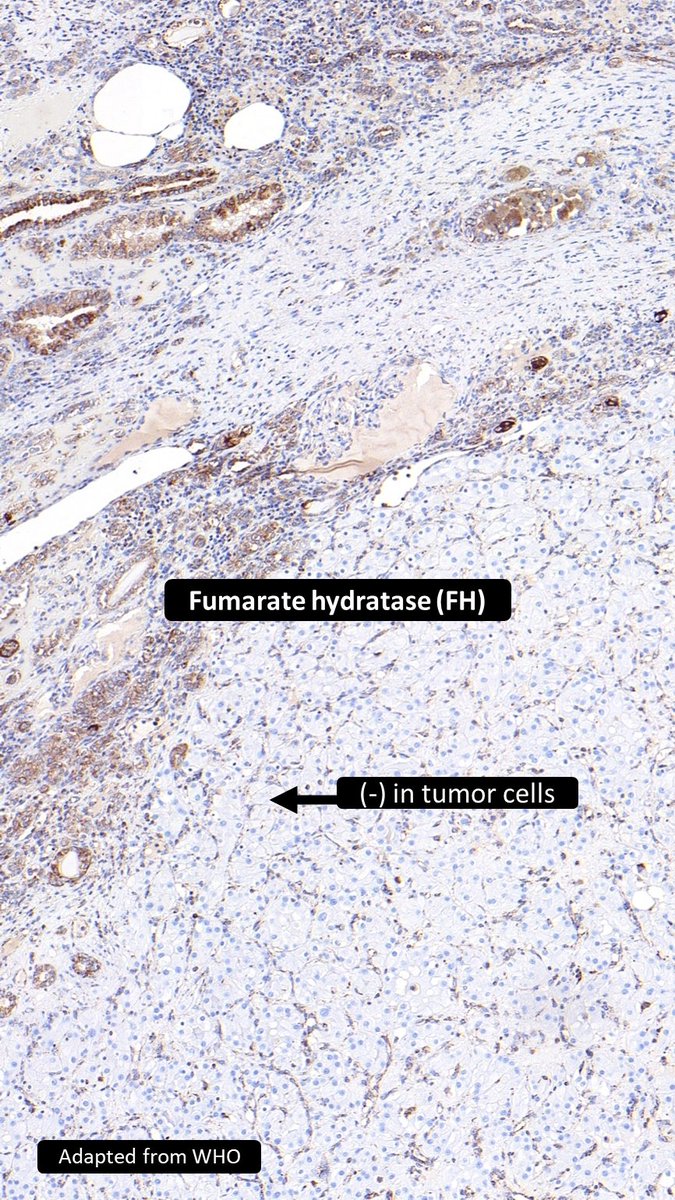 Charlie Herndon tweet media