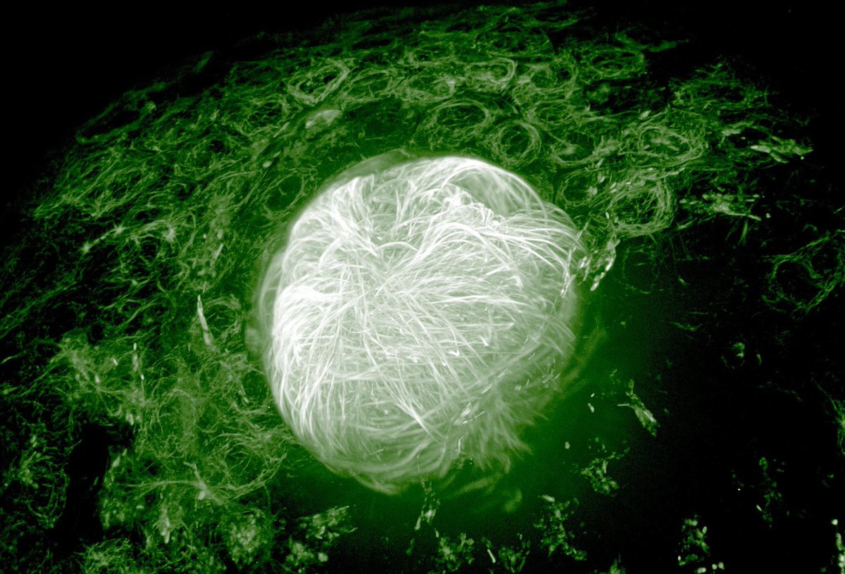 Zebrafish Rock! (@zebrafishrock) on Twitter photo Microtubules in the embryonic zebrafish eye. Credit to <a href="/dancastranova/">Daniel Castranova</a>. #ZebrafishZunday Microtubules in the embryonic zebrafish eye. Credit to <a href="/dancastranova/">Daniel Castranova</a>. #ZebrafishZunday