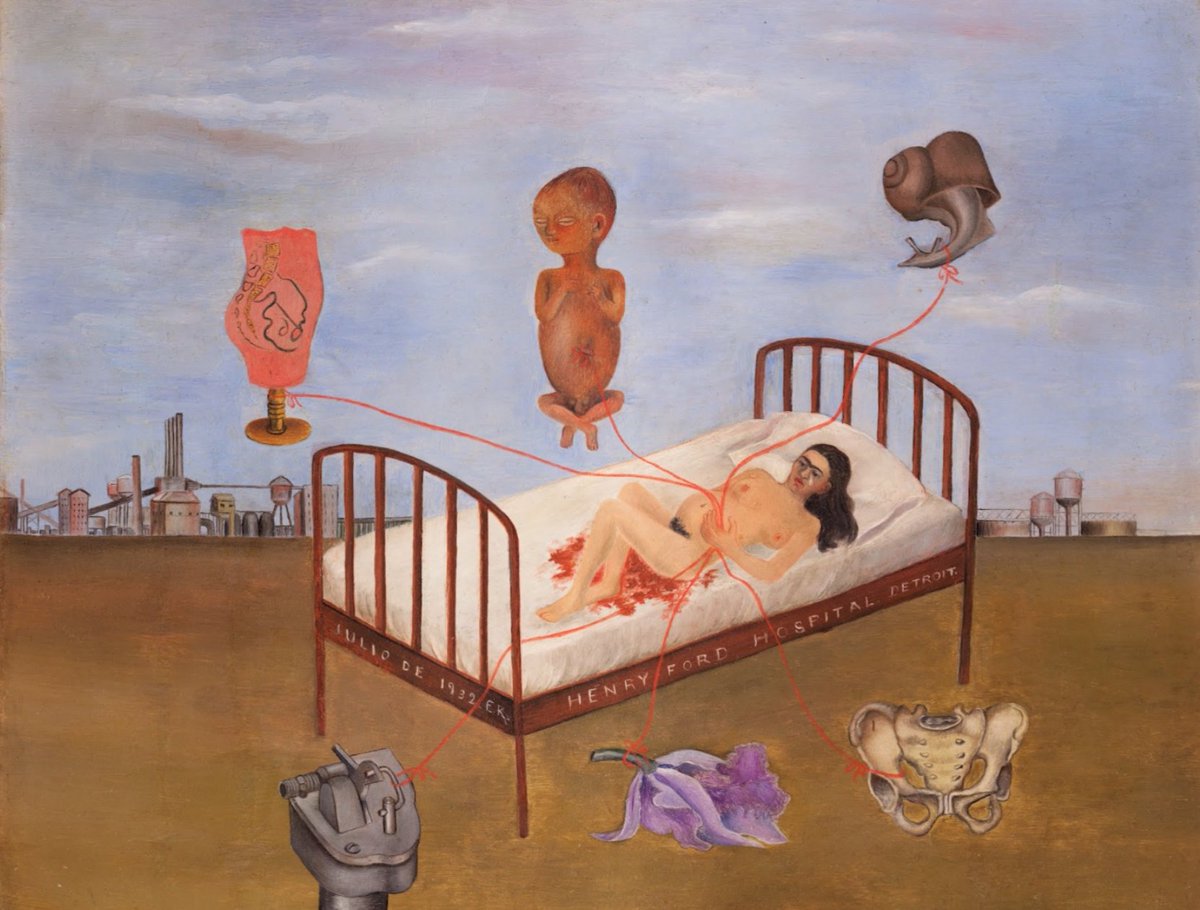 Frida se representa tumbada sobre una cama hospitalaria en medio de un paisaje desolado, sostiene un hilo rojo q conecta elementos simbólicos: el feto d su hijo perdido, una flor marchita, un caracol q representa el lento paso del tiempo, una pelvis rota, y una máquina industrial