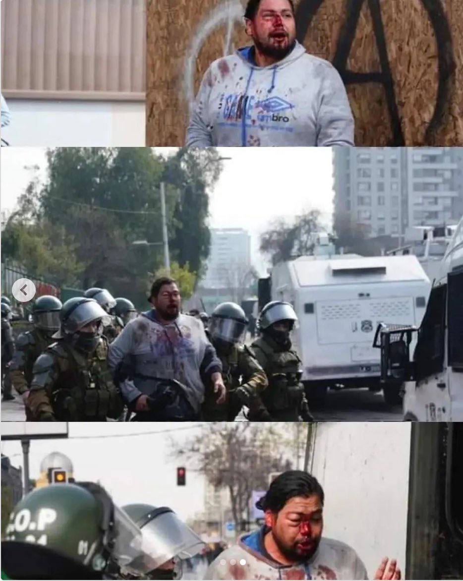 🔴 Noticia en desarrollo

Este es el Venezolano que apuñalo a tres personas durante la romería, cuadras antes de llegar al Cementerio General.

Hace una 1 hora aproximadamente falleció uno de los jóvenes.

¿Por qué migrantes venezolanos salen a atacarnos cuando marchamos por los