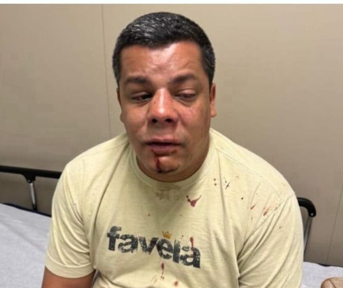 Leonel de Esquerda <a href="/leonelquerino/">Leonel de Esquerda</a>, candiato a vereador pelo PT-RJ, acaba de ser ESPANCADO por bolsonaristas no Rio de Janeiro a mando do fascista Rodrigo Amorim (o que homenageou os assassinos da MARIELLE ao quebrar a placa dela)

O Bolsonarismo é uma facção criminosa!