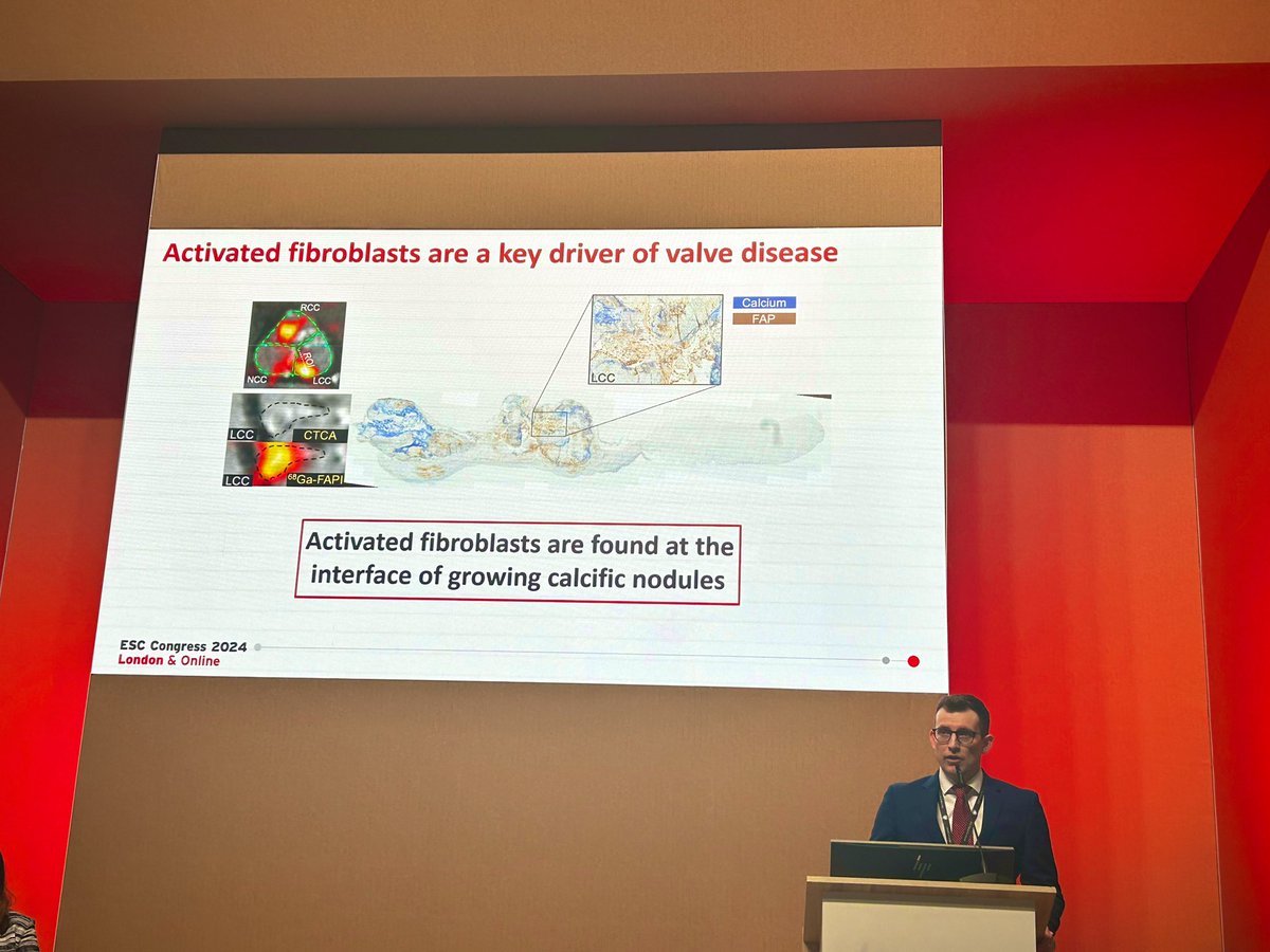Krithika Loganath (@krithikalogana2) on Twitter photo A big #ESC2024 for my good friend <a href="/neiljcraig/">Neil Craig</a> and Team Edinburgh. Congratulations on winning the YIA award for Imaging 🥳🥳 Very well deserved! <a href="/AnnaKateBarton/">Anna Kate Barton</a> <a href="/hannahmcostello/">Hannah Costello</a> @khwaynyo <a href="/mike_mcdermott1/">Michael McDermott</a> <a href="/imagingmedsci/">imagingmedsci</a> <a href="/sjoshi_23/">Shruti Joshi</a> <a href="/russeverett3/">Russell Everett</a> <a href="/menaka_cardio/">menaka mahendran</a> <a href="/JolienGeers/">Jolien Geers</a> #YIA A big #ESC2024 for my good friend <a href="/neiljcraig/">Neil Craig</a> and Team Edinburgh. Congratulations on winning the YIA award for Imaging 🥳🥳 Very well deserved! <a href="/AnnaKateBarton/">Anna Kate Barton</a> <a href="/hannahmcostello/">Hannah Costello</a> @khwaynyo <a href="/mike_mcdermott1/">Michael McDermott</a> <a href="/imagingmedsci/">imagingmedsci</a> <a href="/sjoshi_23/">Shruti Joshi</a> <a href="/russeverett3/">Russell Everett</a> <a href="/menaka_cardio/">menaka mahendran</a> <a href="/JolienGeers/">Jolien Geers</a> #YIA