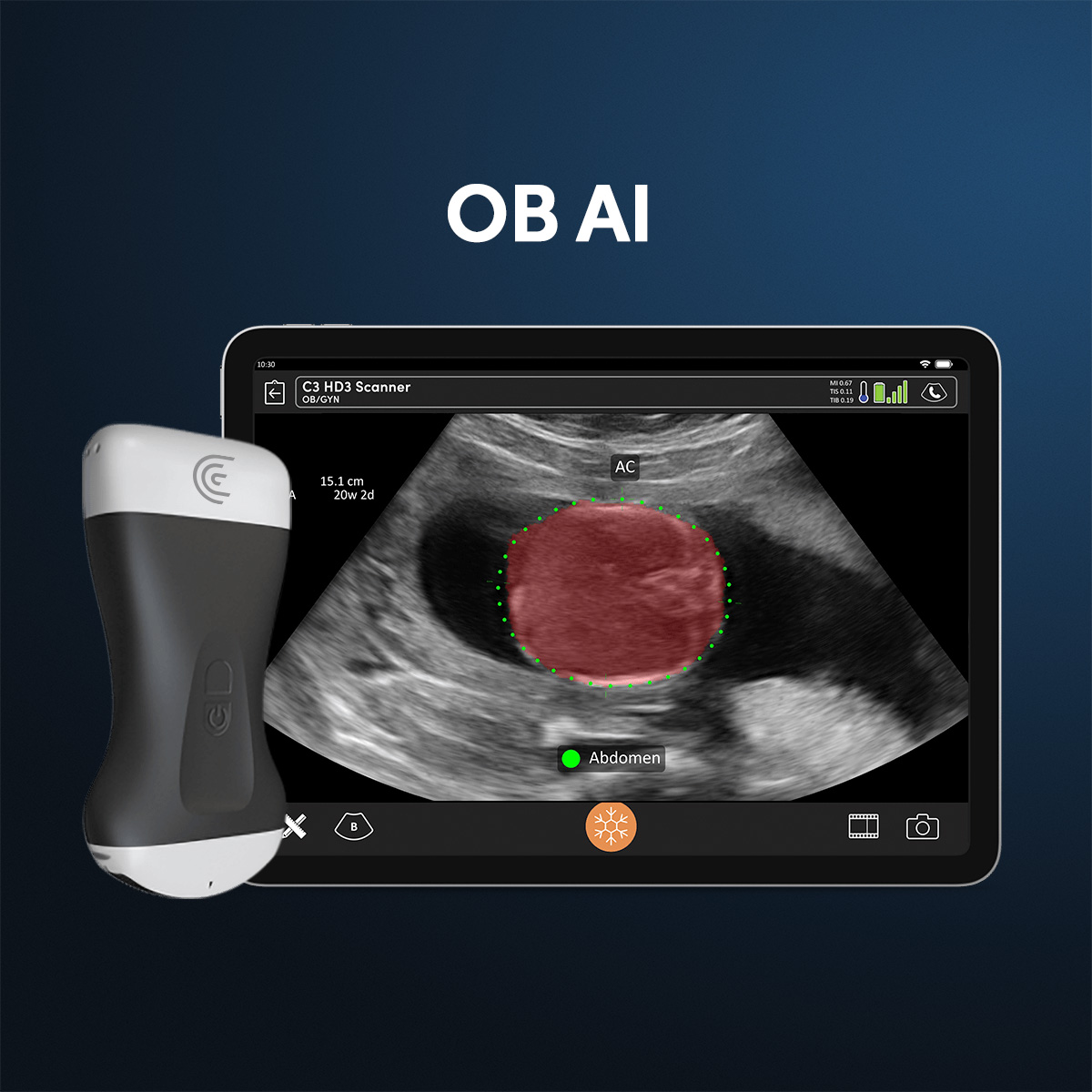 clariusmhealth's tweet photo. 🤖 Spotlight on Clarius AI: OB AI

Clarius OB AI is helping to make obstetrical ultrasound more accessible by automatically estimating fetal age, weight and growth intervals. Learn more 👉 https://t.co/JOrERJRkYv https://t.co/11npO0rhkE