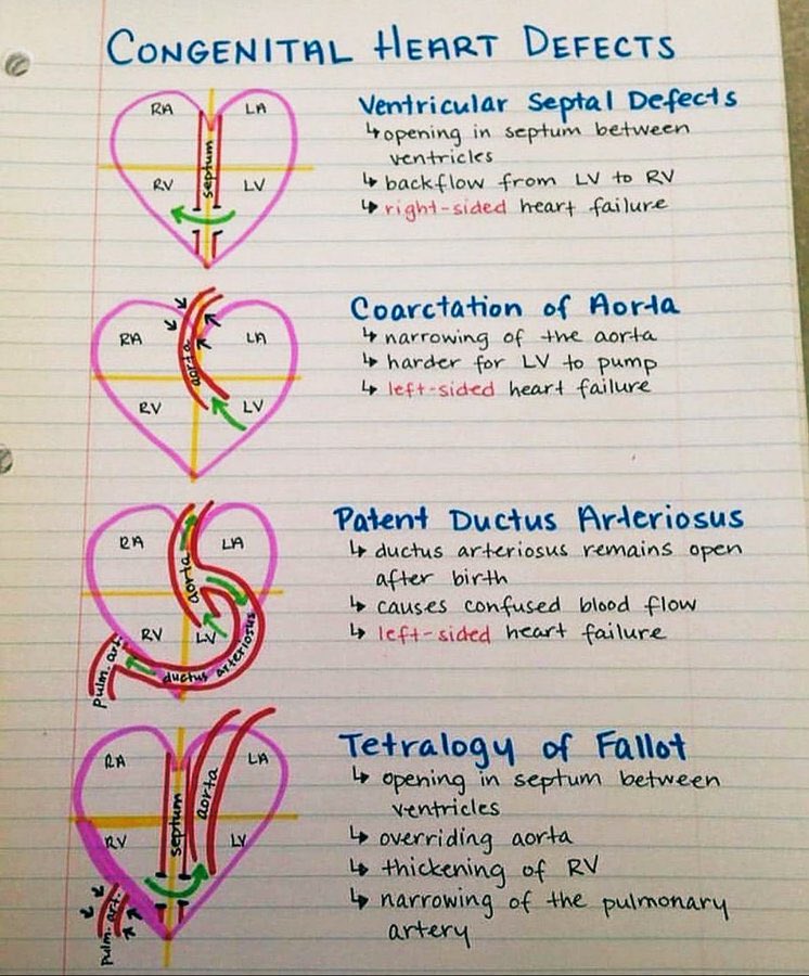 Doctors__squad's tweet photo. Congenital heart defects. https://t.co/RPkx0F6bNT