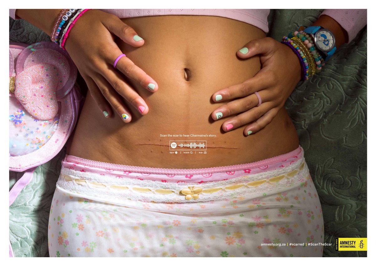 joepublicadv's tweet photo. @AmnestySAfrica launched a campaign highlighting child &amp; teenage pregnancy in South Africa. Partnering with NGOs working with pregnant girls, we told the girls’ stories from their perspective.

Search ‘Scarred’ on Spotify.
Take action: https://t.co/bkRn23YdBk

#ScanTheScar https://t.co/rULRwIYQ70