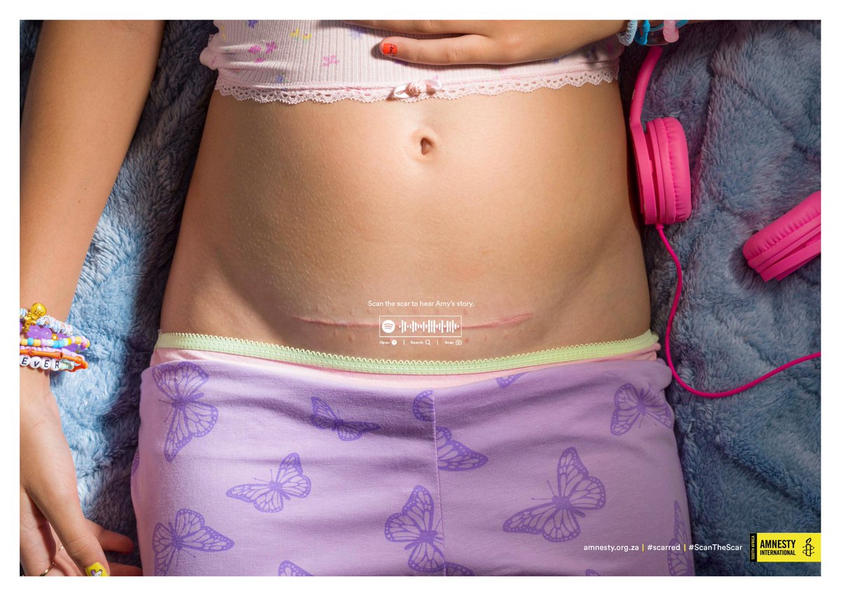 joepublicadv's tweet photo. @AmnestySAfrica launched a campaign highlighting child &amp; teenage pregnancy in South Africa. Partnering with NGOs working with pregnant girls, we told the girls’ stories from their perspective.

Search ‘Scarred’ on Spotify.
Take action: https://t.co/bkRn23YdBk

#ScanTheScar https://t.co/rULRwIYQ70