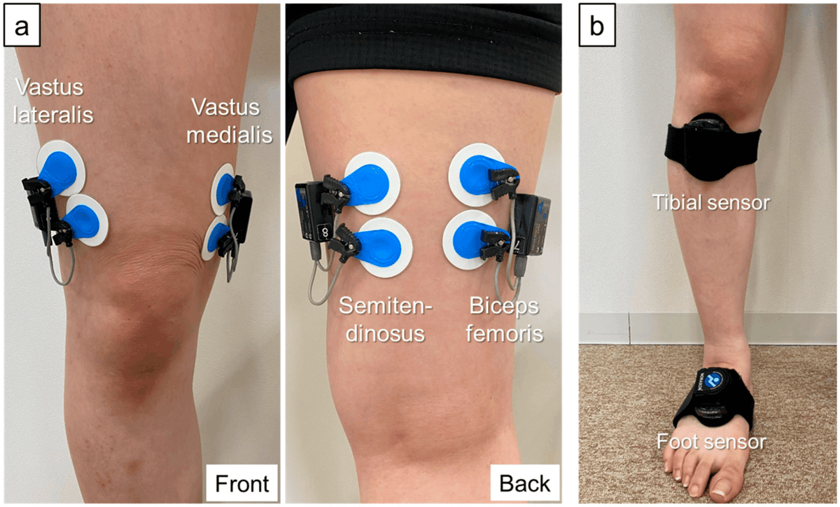 PhysioMeScience's tweet photo. Relationship between Fear-Avoidance Beliefs and Muscle Co-Contraction in People with Knee Osteoarthritis

https://t.co/l97uBE7IpE https://t.co/4D9AuROQCl