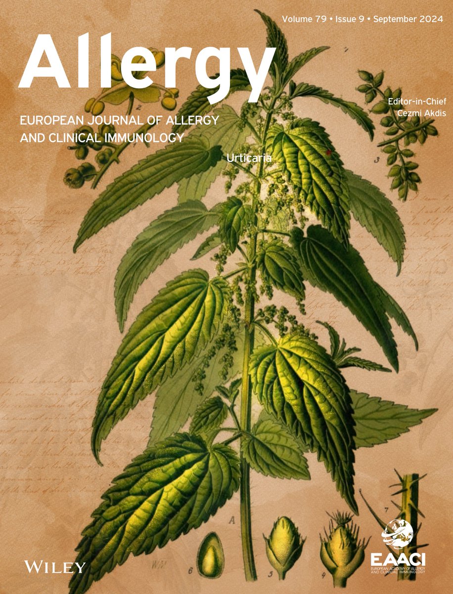 #Urticaria, a common and heterogeneous inflammatory skin disorder, derives its name from the Latin word "urtica," meaning nettle. This etymology reflects the striking resemblance between urticarial lesions and the stinging rash caused by contact with stinging nettles, especially