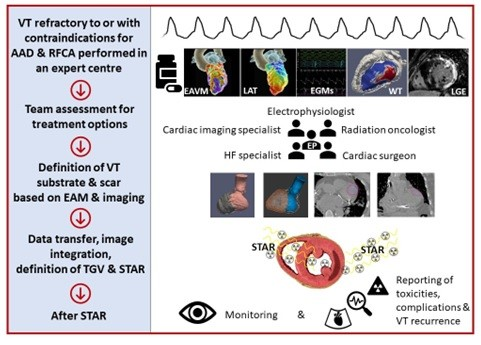 Europace Editor-in-Chief (@europaceeic) on Twitter photo #Europace #Epeeps
💡EHRA/HRS consensus statement on cardiac arrhythmia☢️radioablation.
A Guide for patient selection, VT substrate delineation
🆓📚doi.org/10.1093/europa…
<a href="/GiulioConte9/">Giulio Conte</a> <a href="/FraSantoroMD/">Francesco Santoro, MD, PhD</a> <a href="/marcovitoloMD/">Marco Vitolo Ⓜ️</a> <a href="/Dominik_Linz/">Dominik Linz</a> <a href="/AndyZhangMD/">Xiaodong Zhang (Andy), MD, PhD, FHRS, FACC</a> <a href="/LuigiDiBiaseMD/">Luigi Di Biase</a> <a href="/BorianiGiuseppe/">Boriani Giuseppe</a> #Europace #Epeeps
💡EHRA/HRS consensus statement on cardiac arrhythmia☢️radioablation.
A Guide for patient selection, VT substrate delineation
🆓📚doi.org/10.1093/europa…
<a href="/GiulioConte9/">Giulio Conte</a> <a href="/FraSantoroMD/">Francesco Santoro, MD, PhD</a> <a href="/marcovitoloMD/">Marco Vitolo Ⓜ️</a> <a href="/Dominik_Linz/">Dominik Linz</a> <a href="/AndyZhangMD/">Xiaodong Zhang (Andy), MD, PhD, FHRS, FACC</a> <a href="/LuigiDiBiaseMD/">Luigi Di Biase</a> <a href="/BorianiGiuseppe/">Boriani Giuseppe</a>