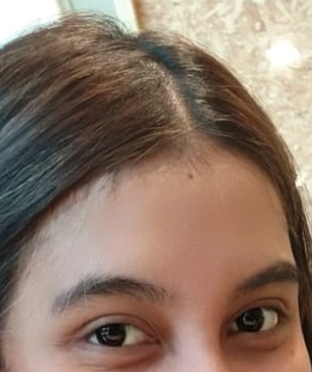 urmocca's tweet photo. april ke agustus.
ku akui tumbuh lab luar biasa. 🫣 https://t.co/2IxNO55a4c