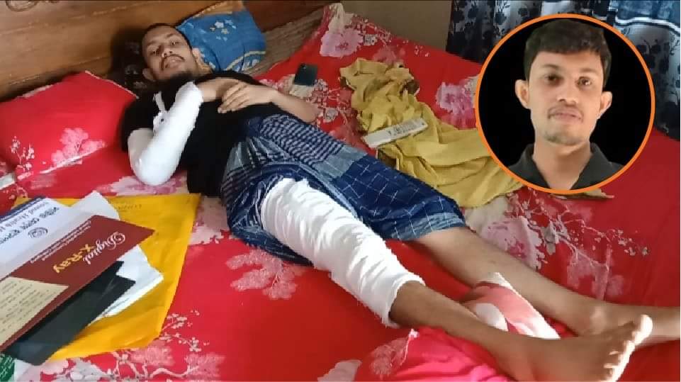 বৈষম্য বিরোধী ছাত্র আন্দোলনে আহত ওয়াহেদ কাতরাচ্ছে বিছানায়, খবর নেয়নি কেউ