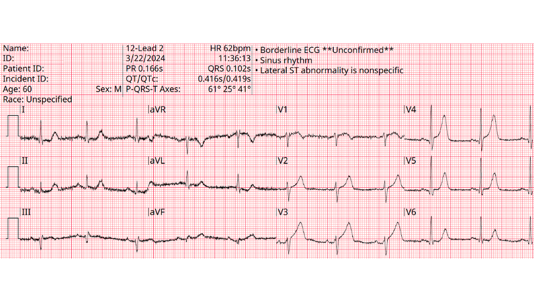 ECGWeekly tweet media