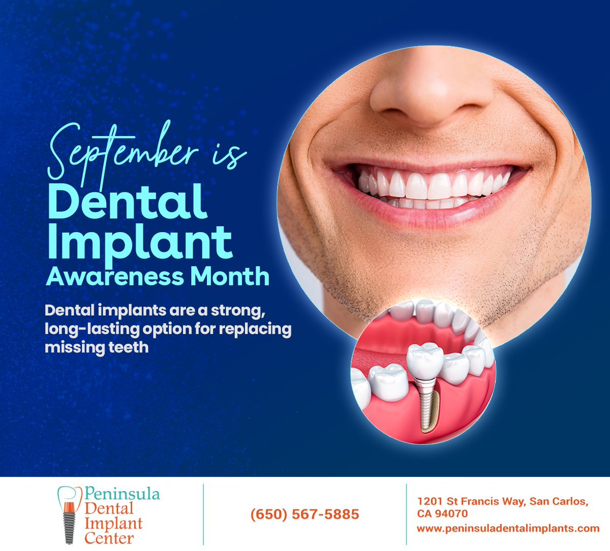 Restore your smile and improve your oral health by replacing missing teeth with dental implants that look and feel natural. To learn more about dental implants, visit peninsuladentalimplants.com #dentalimplantawareness #redwoodcity #CA #peninsuladentalimplants