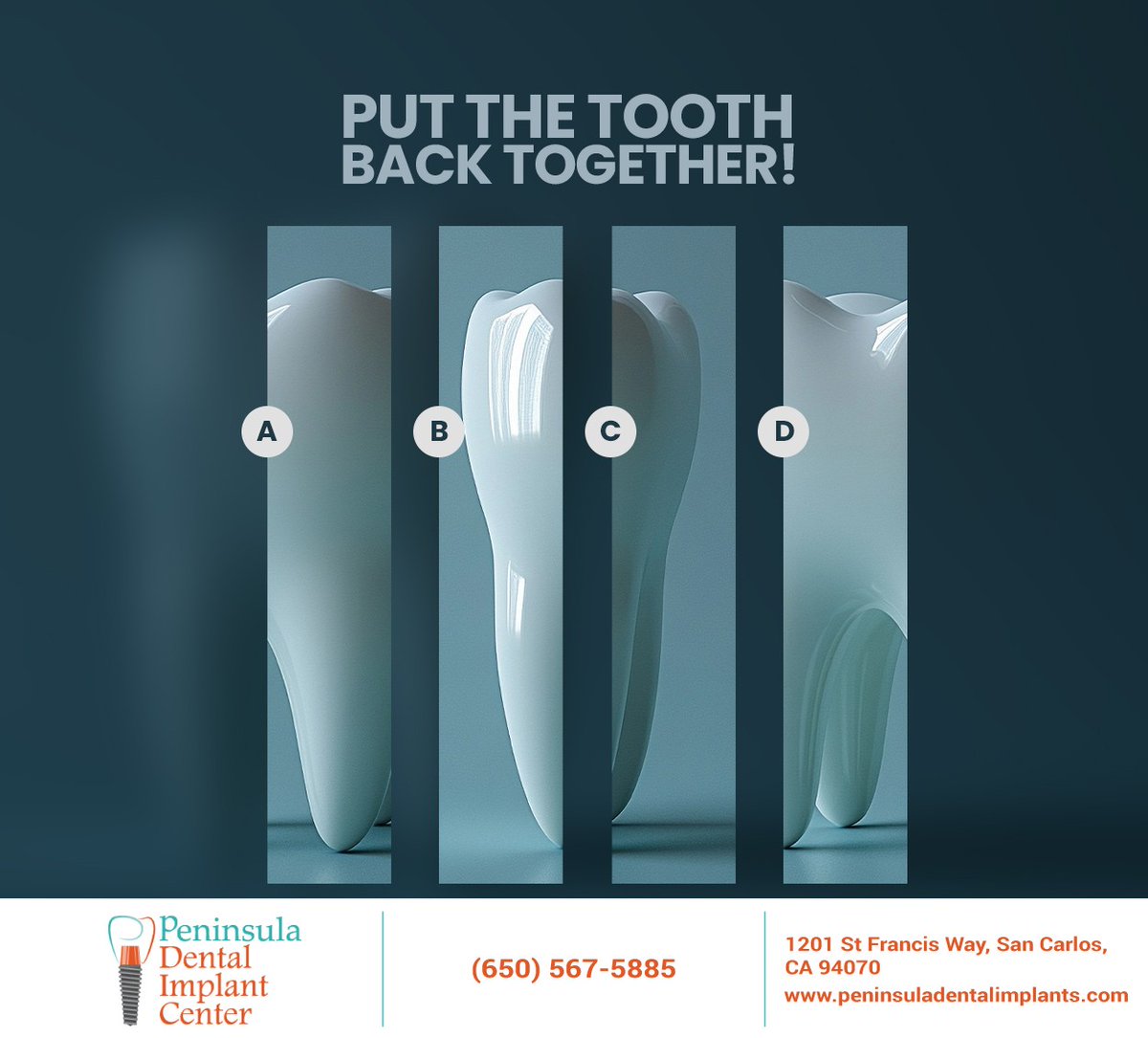 Can you choose the right order to put the tooth back together? Comment with the right order and let’s see who gets it right. #toothpuzzle #dentistry #redwoodcity #CA #peninsuladentalimplants