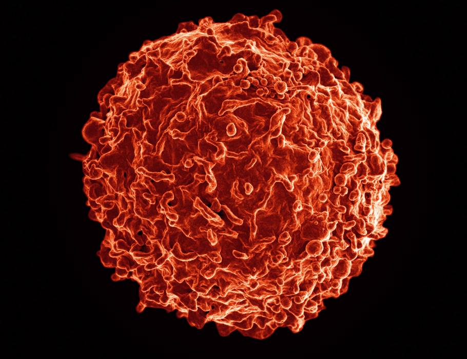 Science Signaling (@scisignal) on Twitter photo A new preclinical study shows that the protein #WNK1—a potential drug target in #cancer and hypertension—also plays important roles in humoral #immunity and #Bcell migration, suggesting scientists should develop WNK1 inhibitors with caution. <a href="/NIAIDNews/">NIAID News</a> scim.ag/8dS A new preclinical study shows that the protein #WNK1—a potential drug target in #cancer and hypertension—also plays important roles in humoral #immunity and #Bcell migration, suggesting scientists should develop WNK1 inhibitors with caution. <a href="/NIAIDNews/">NIAID News</a> scim.ag/8dS