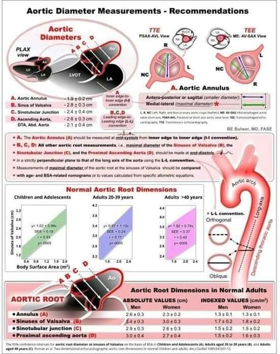 🔴Echocardiographic Aortic Diameter Measurement Recommendations⤵️🔹

 #Cardiology #FOAMed #MedEd #medstudent #paramedic #Cardiology #CardioEd #medtwitter #meded #CardioTwitter #cardiotwiteros  #MedX #cardiovascular #MedTwitter #medical #medEd #cardiotwitter #medicineball