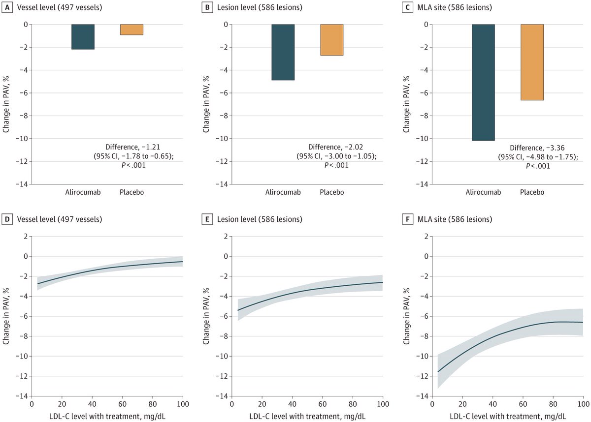 Lorenz Räber, MD PhD (@raberlorenz) on Twitter photo #PCSK9i plus high-intensity statin therapy achieves
2% plaque burden regression at vessel level
5% PB regression at LESION level
10% PB regression at the most narrow (MLA) vessel spot
Just published <a href="/JAMACardio/">JAMA Cardiology</a>
<a href="/FBiccire/">Flavio Biccirè</a>
jamanetwork.com/journals/jamac… #PCSK9i plus high-intensity statin therapy achieves
2% plaque burden regression at vessel level
5% PB regression at LESION level
10% PB regression at the most narrow (MLA) vessel spot
Just published <a href="/JAMACardio/">JAMA Cardiology</a>
<a href="/FBiccire/">Flavio Biccirè</a>
jamanetwork.com/journals/jamac…