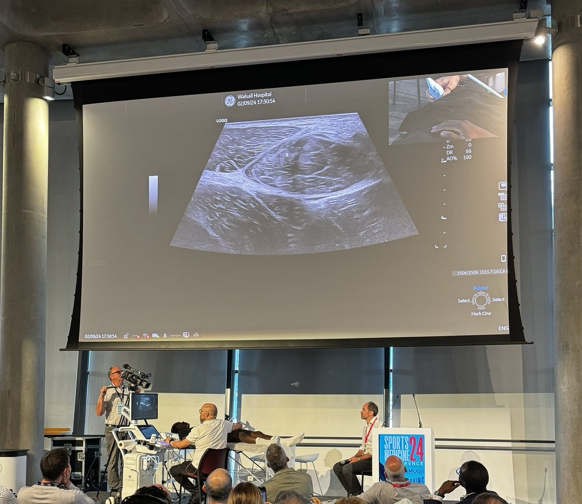 Stuart Butler (@physiobutler) on Twitter photo And to finish up the day <a href="/carlespedret/">carlespedret</a> scanning Rectus Femoris with possibly the biggest second screen ever seen in POCUS 📺 !!! #SMC2024 <a href="/CMyersPhysio/">Chris Myers - Physio and Lecturer</a> <a href="/SportsMedConf/">Sports Medicine Conference 2025</a> <a href="/SMUGcourses/">MSK Ultrasound</a> And to finish up the day <a href="/carlespedret/">carlespedret</a> scanning Rectus Femoris with possibly the biggest second screen ever seen in POCUS 📺 !!! #SMC2024 <a href="/CMyersPhysio/">Chris Myers - Physio and Lecturer</a> <a href="/SportsMedConf/">Sports Medicine Conference 2025</a> <a href="/SMUGcourses/">MSK Ultrasound</a>