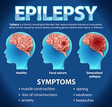 Janietip's tweet photo. @KingsCollegeNHS #ACP ED CPD day. Presentations on Parkinson’s Disease Headache and Epilepsy services. #CasePresentations  #Digoxintoxcity #Leptospirosis #Lymphoma #Campylobacter #neurology #ARCA https://t.co/5pKvuPP9UF