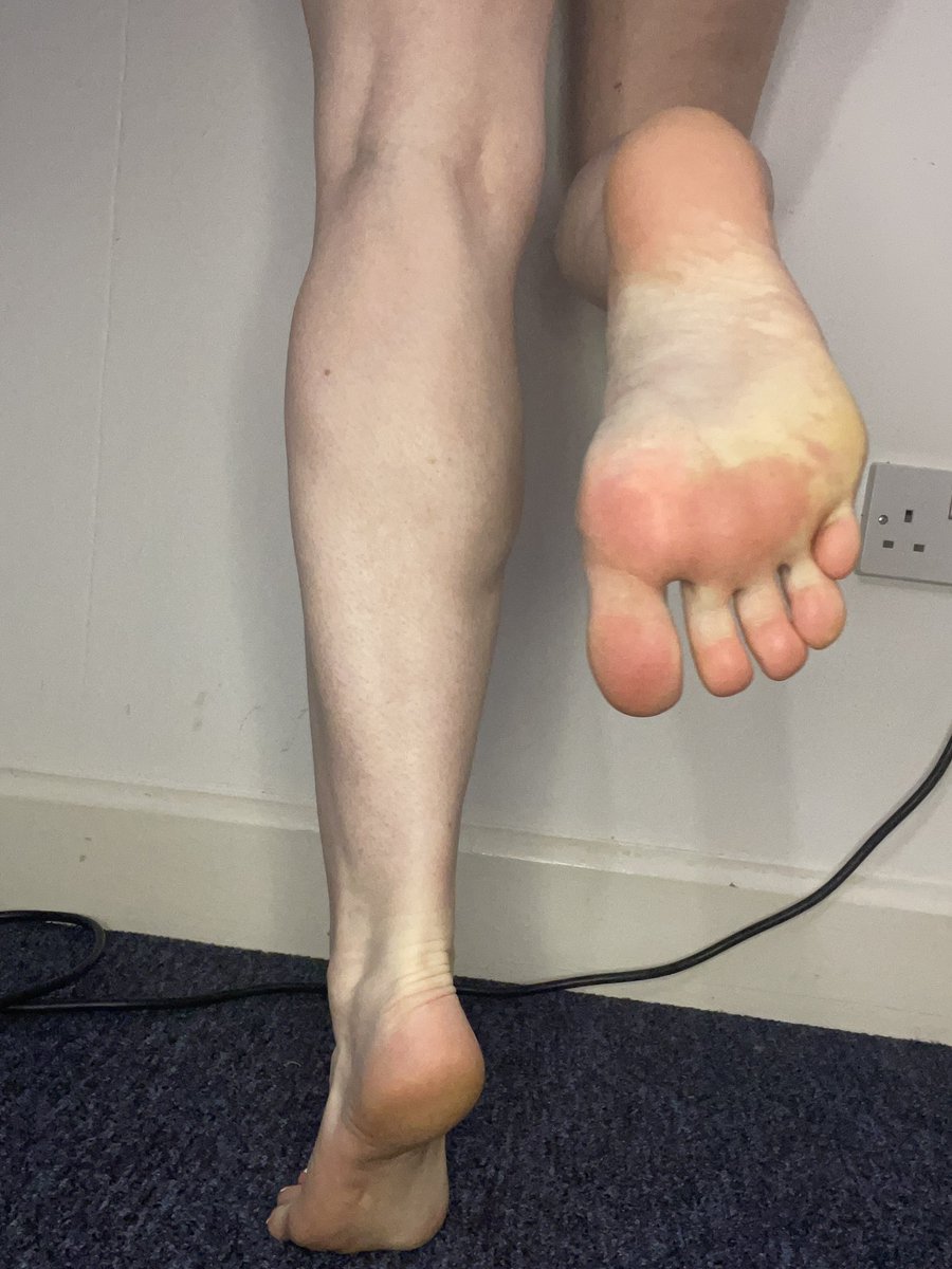 NorthernNympho's tweet photo. Stare into my soles… and then worship them   
New album up on my feet finder. Linked in bio https://t.co/JlPAcnMypG
