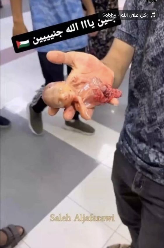 Daha doğmamış bebekler bile bombalanıp parçalandı 

İsrail’in içinden geçmek için yüzbinlerce fırsat doğdu ama Allah nasip etmiyor onca silahları ve orduları ile müslüman liderleri ve ordularının basireti bağlanmış öylece katliamı izliyorlar yetmiyor izletiyorlar 

Gazze ..